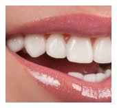 dental crown New York and Great Neck